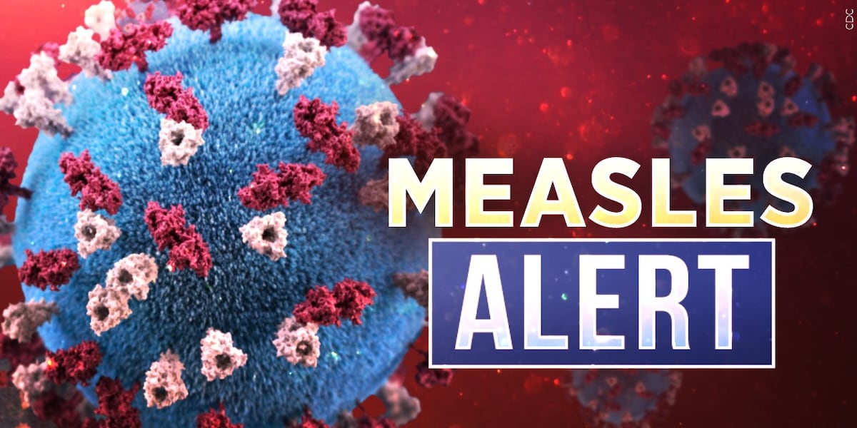 Second confirmed measles case reported in Platte County